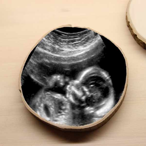 blad Familielid bouwen Boomschijf met baby echofoto - echo foto kado - Zwangerschapskado